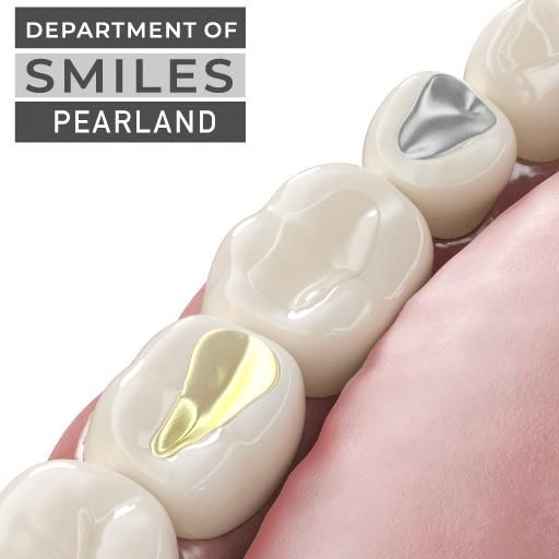Tooth-colored dental filling treatment in Pearland, TX